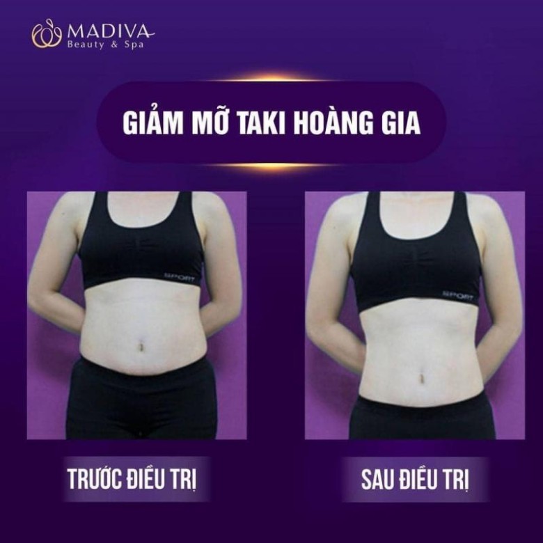 Một số dịch vụ nổi bật tại Madiva Beauty Spa