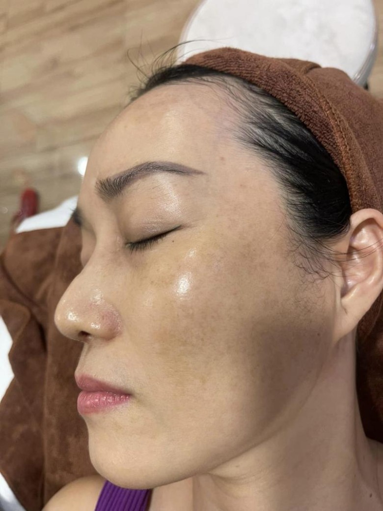 Một số gói làm đẹp được phục vụ bởi Sunshine Spa Beauty Clinic